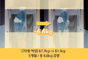 [70대 여성] 5개…